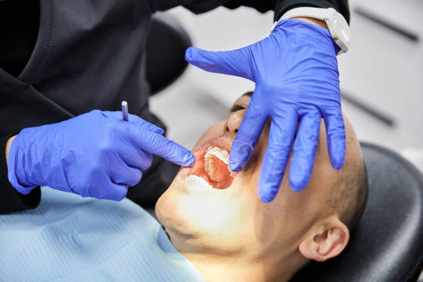 Best Emergency Root Canal Treatment in Gamewell, NC