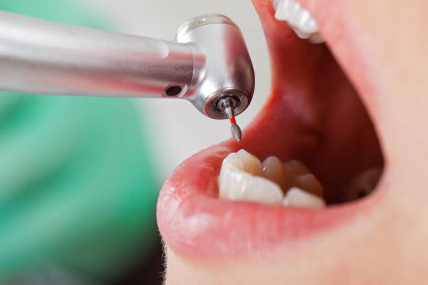 Best Weekend Emergency Dentist in Gamewell, NC